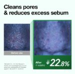 ANUA Heartleaf Pore Control Cleansing Oil - Image 5