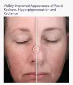 Alastin C Radical Defense Antioxidant Serum - Image 8