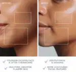BEAR™ mini Facial Toning Device - Image 4