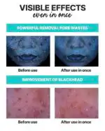 Mediheal Mogongtox Soda Bubble Mask - Image 5