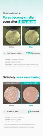 MEDITHERAPY Porethera Shot Exosome Spicule Serum & Minimizer Set - Image 3