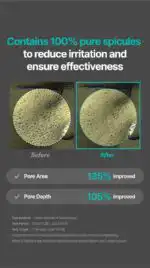 MEDITHERAPY Porethera Shot Exosome Spicule Serum & Minimizer Set - Image 6