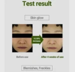 MEDI-PEEL Dr. Green Vitamin Ampoule Glow & Bright - Image 4