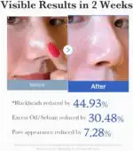 Medicube Zero Pore Pad - Image 5