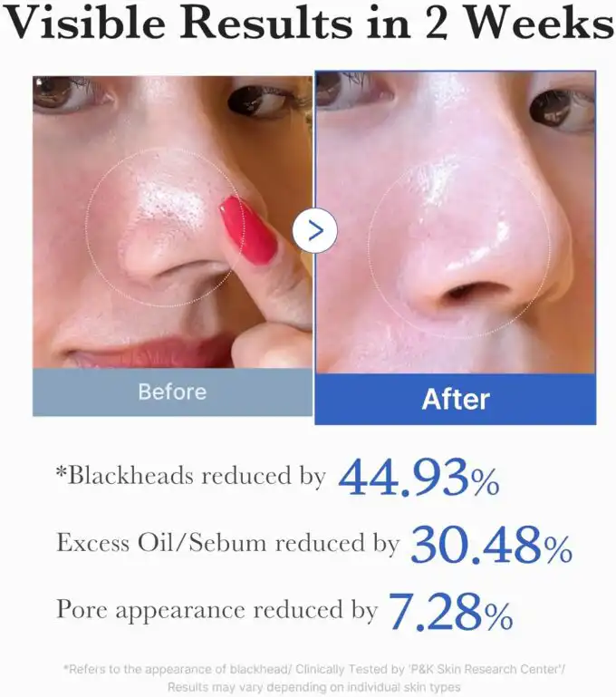 Medicube Zero Pore Pad - Image 5