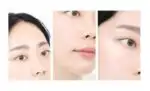 BioHeal BOH Probioderm Lifting Micro Wrinkle Patch Set - Image 4