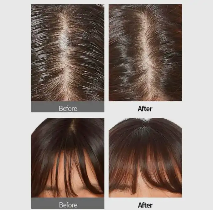 APIEU Oily Hair Dry Powder - Image 2