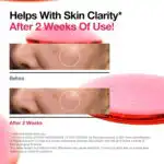ANUA Niacinamide 10% + TXA 4% Serum - Image 5