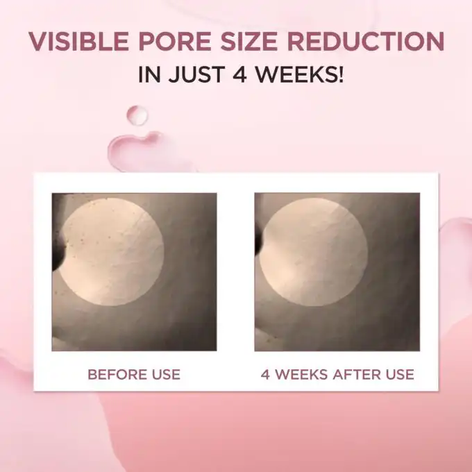 Centella Skincare Routine Set | Clear, Calm & Glow Daily - Image 4
