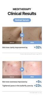 Meditherapy Retinal Skin Booster Serum 5 oz. - Image 7