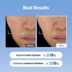 Meditherapy Hyaluronic Acid Skin Booster First Serum 5oz. - Image 7