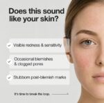 10% Azelaic Acid Serum 30ml (Trouble Care, Redness Soothing, Pore Refining) - Image 3