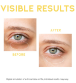 Red Light Eye Therapy Device with OOTD+ VC+ Dark Circle Eye Serum - Image 7