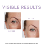 #OOTD Day & Night Eye Renewal Set: Dark Circle Eye Serum + Overnight Peptide Eye Cream - Image 3